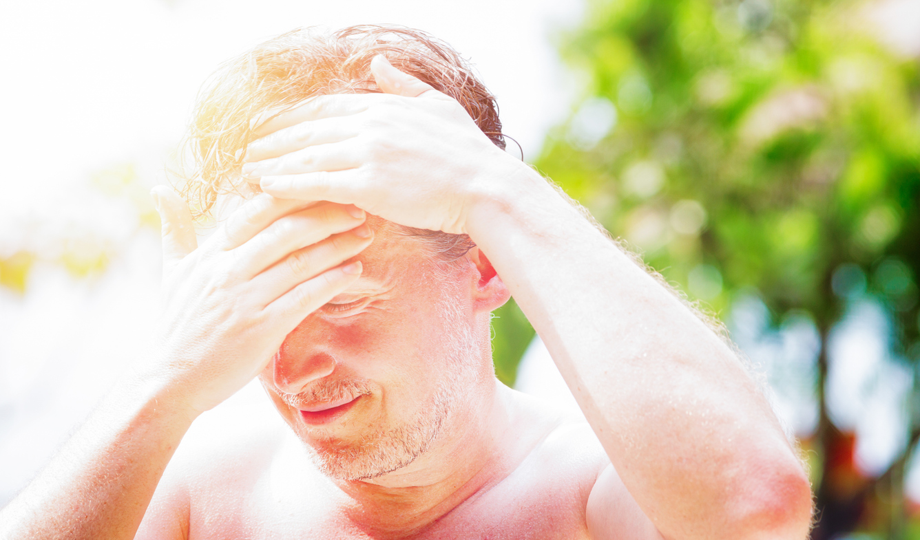 Rob heeft zonschade op zijn hoofd: 'Hoe kan ik mijn hoofdhuid het beste